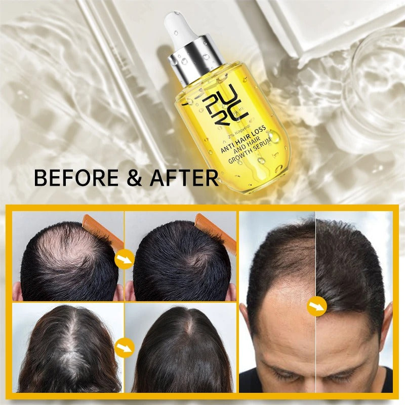 LeDoche | LuxeFollicle Hair Growth Serum