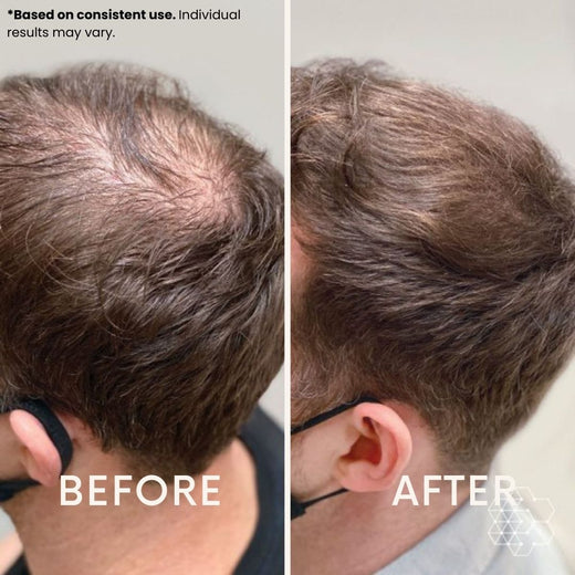 LeDoche customer result - Kevin M.