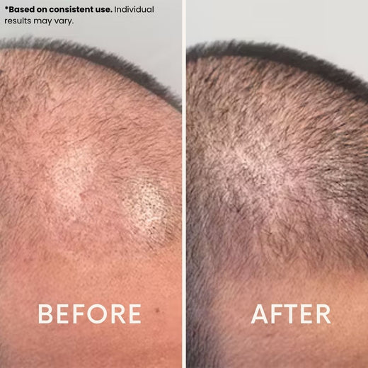 LeDoche customer result - Aaron C.