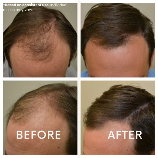 LeDoche customer result - Daniel P.
