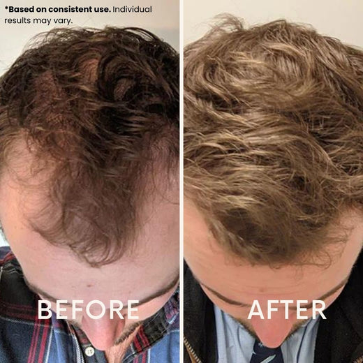 LeDoche customer result - Brian S.