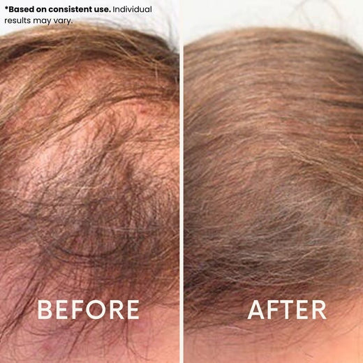 LeDoche customer result - Michael T.