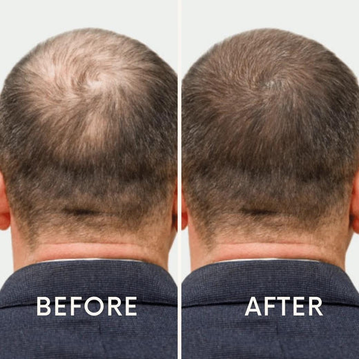 LeDoche customer result - James P.