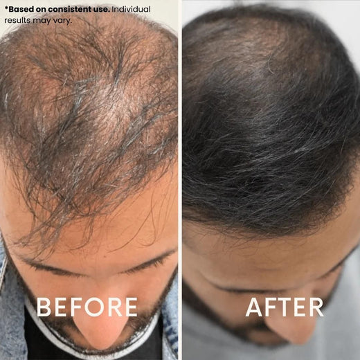 LeDoche customer result - Luke H.