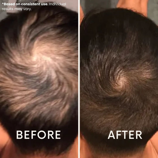 LeDoche customer result - Noah F.