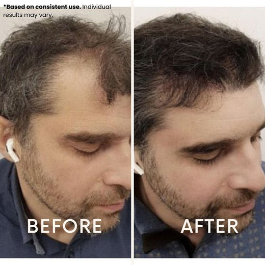 LeDoche customer result - Oliver G.