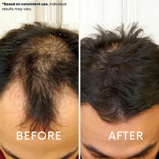 LeDoche customer result - Ethan B.
