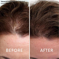 LeDoche Red Light Therapy Hat LeDoche Haircare.
