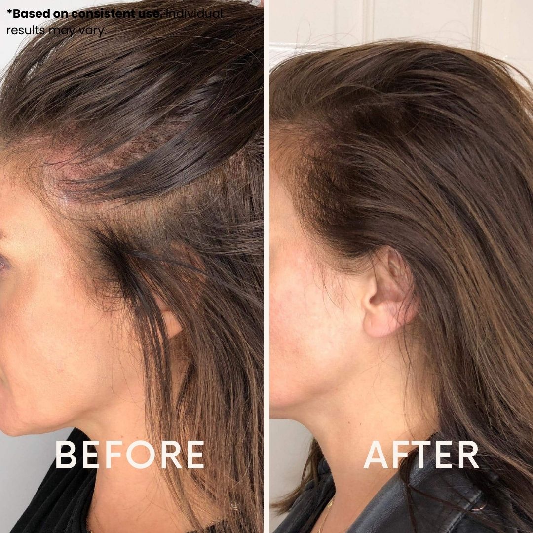 LeDoche HairRevive Dual Red Light Therapy Hat