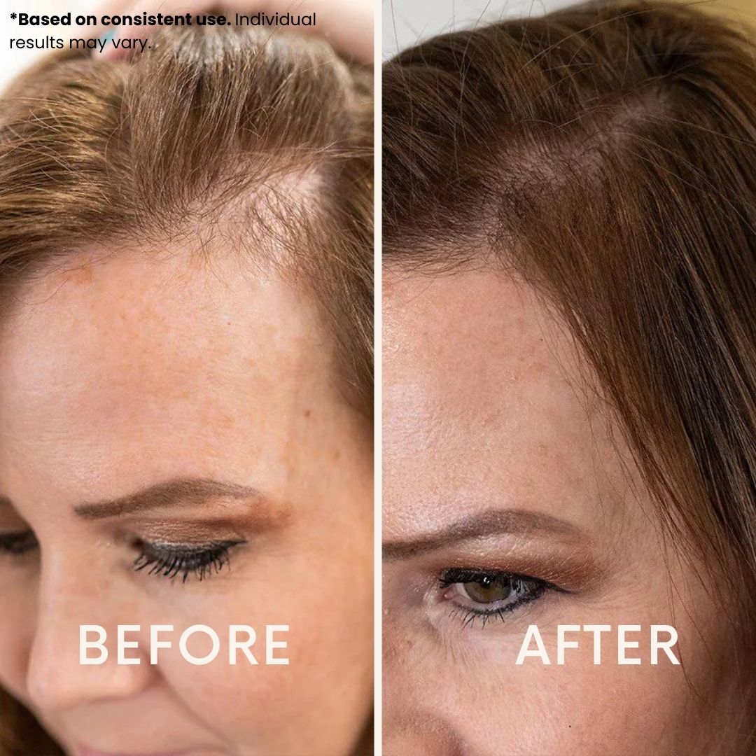 LeDoche HairRevive Dual Red Light Therapy Hat