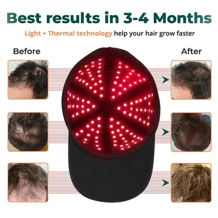 LeDoche | HairRevive Dual Red Light Therapy Cap Hat