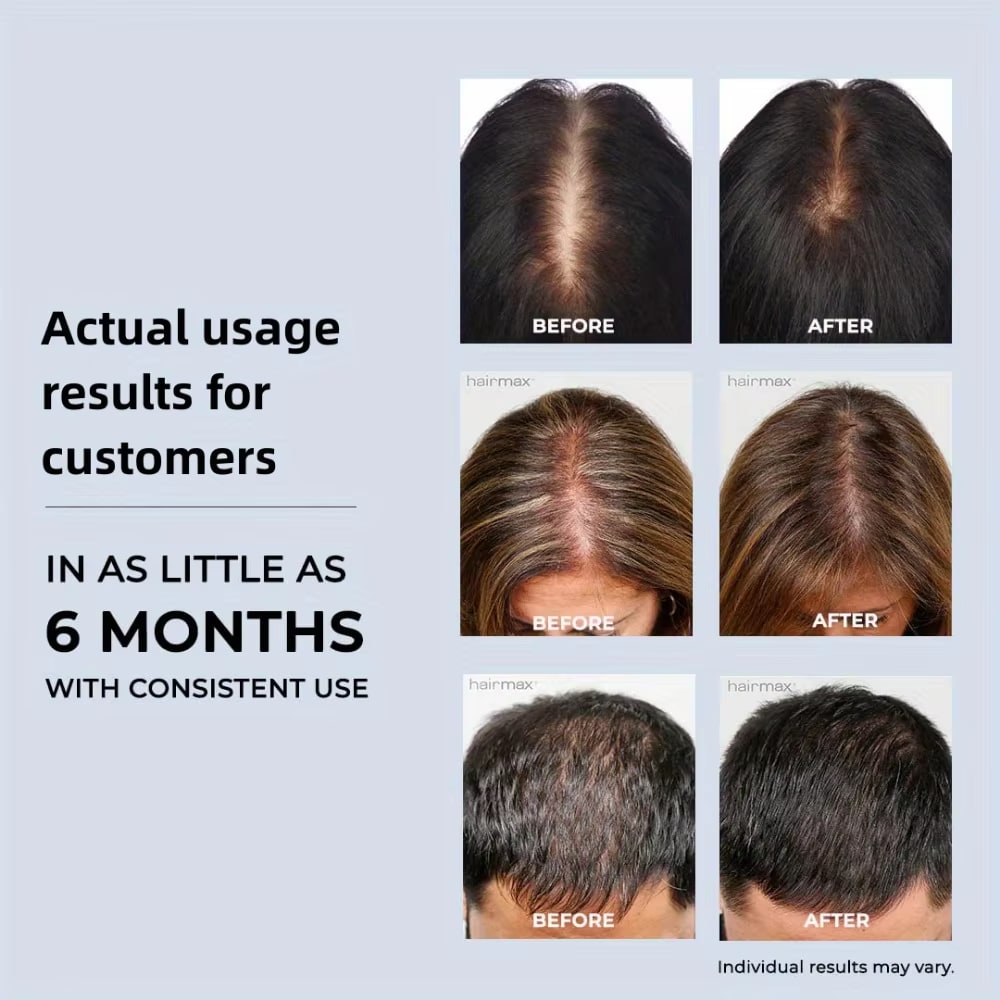 LeDoche | HairRevive Dual Red Light Therapy Cap Hat