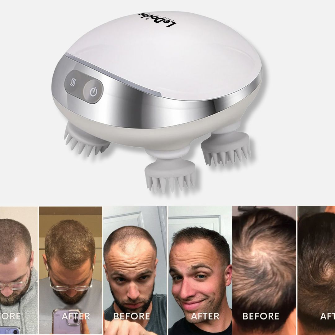 LeDoche | ScalpRevive Massager