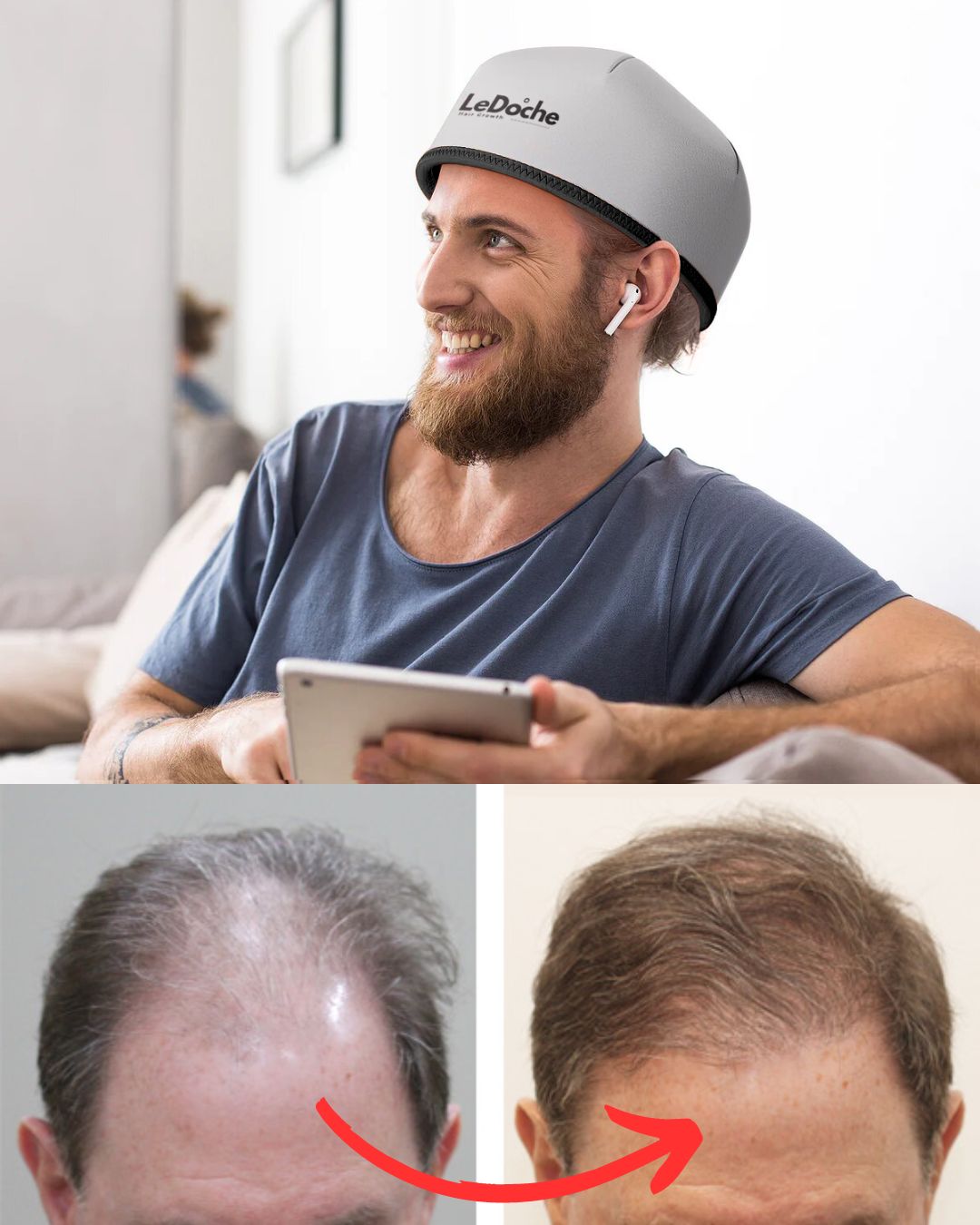 LeDoche Red Light Therapy Hat + 1 Hair Growth Serum